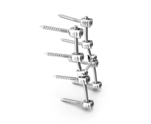 Bone Plates and Screws manufacturing using laser laser solutions of SLTL
